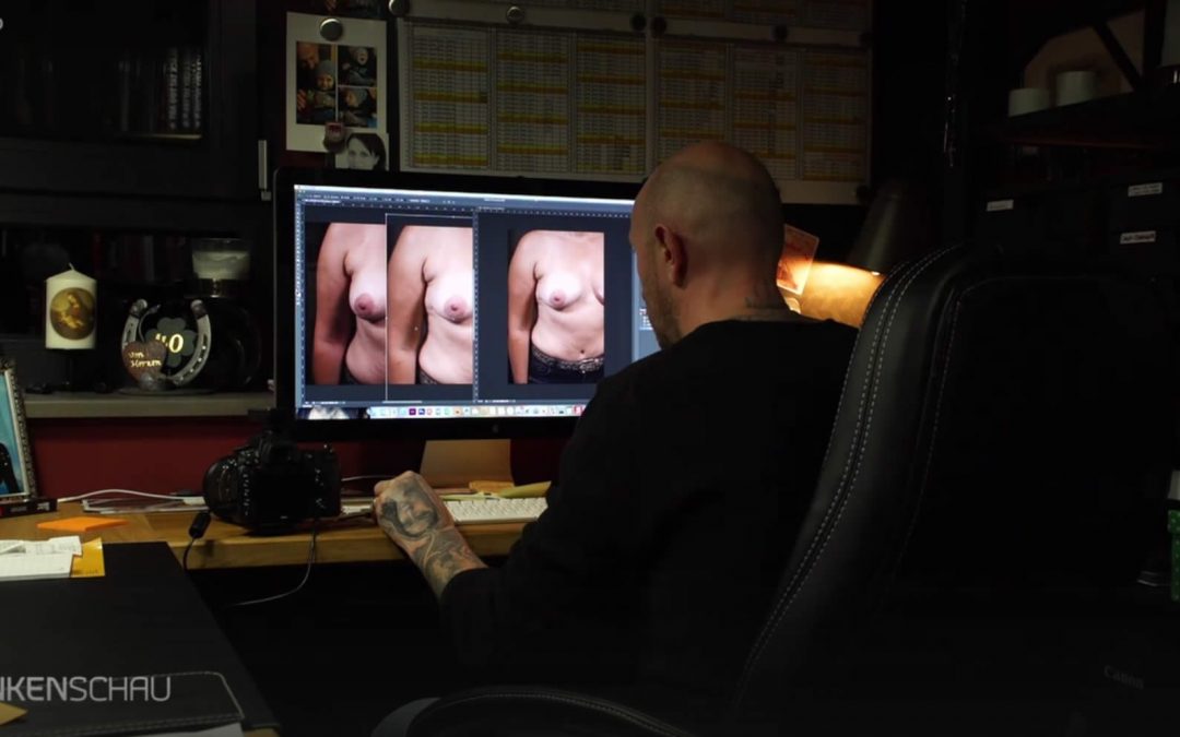Andy Engel in der BR Frankenschau zum Thema MedTattoo
